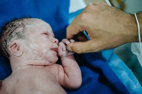 Fotografia de parto na maternidade Ilha em Florianópolis, cesárea, registros por Thiago Braga fotografia'