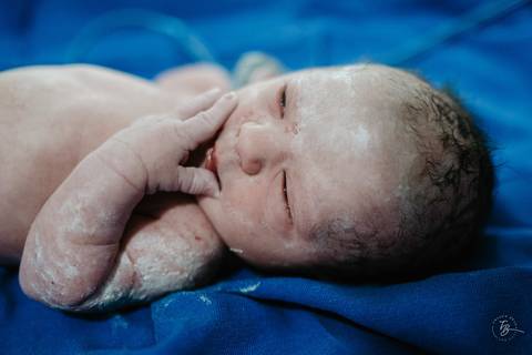 Fotografia de parto na maternidade Ilha em Florianópolis, cesárea, registros por Thiago Braga fotografia'