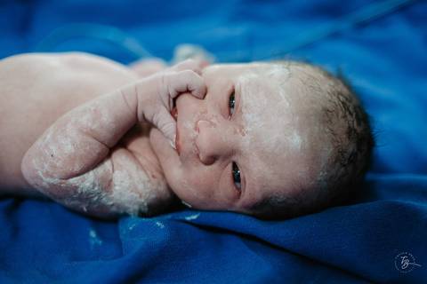 Fotografia de parto na maternidade Ilha em Florianópolis, cesárea, registros por Thiago Braga fotografia'