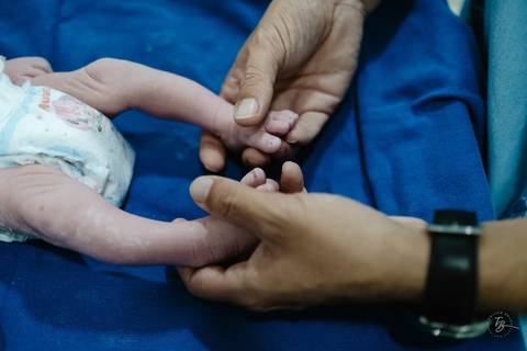Fotografia de parto na maternidade Ilha em Florianópolis, cesárea, registros por Thiago Braga fotografia'