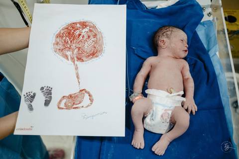 Fotografia de parto na maternidade Ilha em Florianópolis, cesárea, registros por Thiago Braga fotografia'