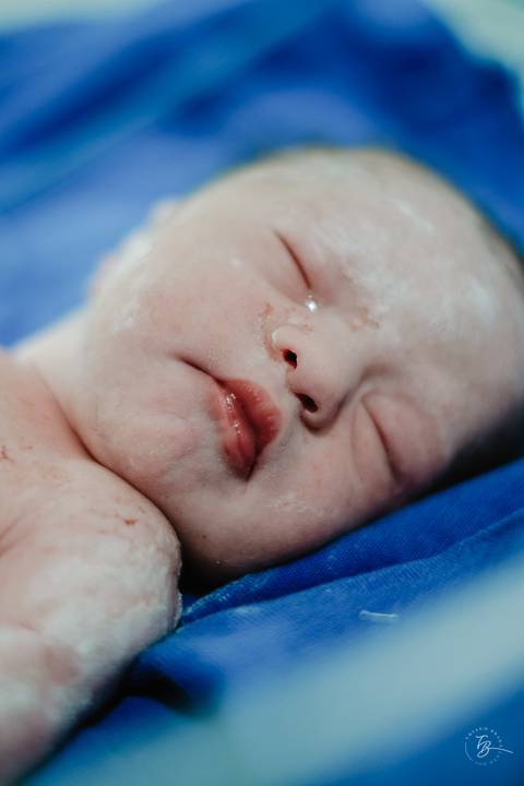 Fotografia de parto na maternidade Ilha em Florianópolis, cesárea, registros por Thiago Braga fotografia'