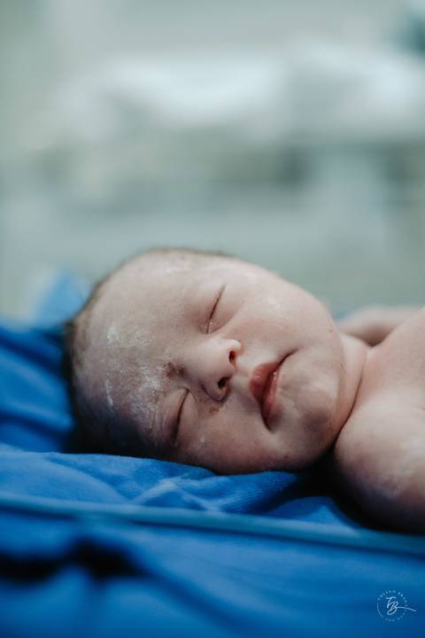 Fotografia de parto na maternidade Ilha em Florianópolis, cesárea, registros por Thiago Braga fotografia'