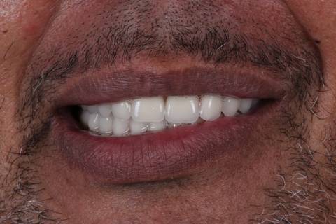 '