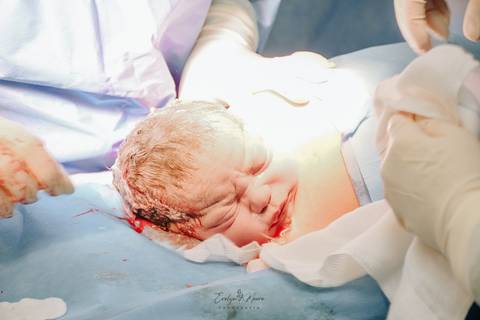 Fotografia de Parto - Newborn - Evelyn Moura Fotografia em Niterói, Rio de Janeiro - ensaio infantil - newborn de recém nascido - partos - parto em niteroi - registro de parto - maternidade são francisco'