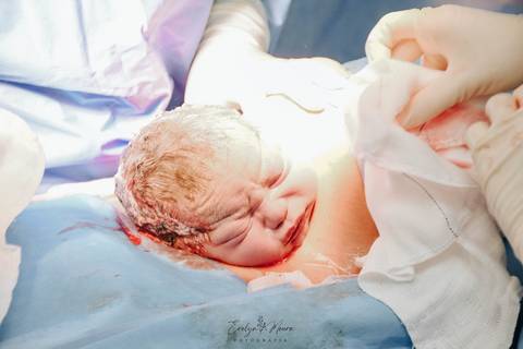 Fotografia de Parto - Newborn - Evelyn Moura Fotografia em Niterói, Rio de Janeiro - ensaio infantil - newborn de recém nascido - partos - parto em niteroi - registro de parto - maternidade são francisco'