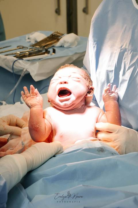 Fotografia de Parto - Newborn - Evelyn Moura Fotografia em Niterói, Rio de Janeiro - ensaio infantil - newborn de recém nascido - partos - parto em niteroi - registro de parto - maternidade são francisco'
