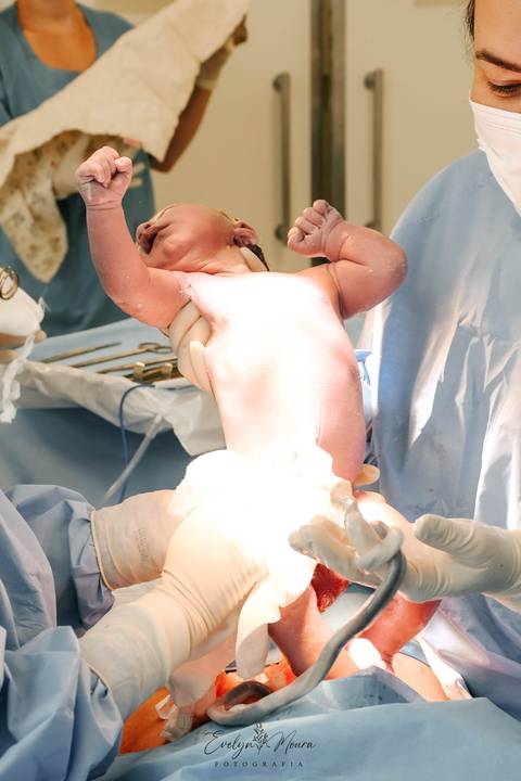 Fotografia de Parto - Newborn - Evelyn Moura Fotografia em Niterói, Rio de Janeiro - ensaio infantil - newborn de recém nascido - partos - parto em niteroi - registro de parto - maternidade são francisco'