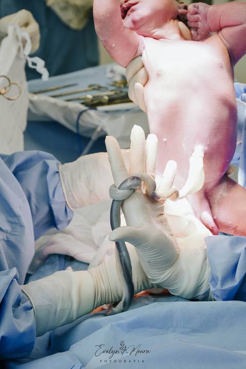 Fotografia de Parto - Newborn - Evelyn Moura Fotografia em Niterói, Rio de Janeiro - ensaio infantil - newborn de recém nascido - partos - parto em niteroi - registro de parto - maternidade são francisco'