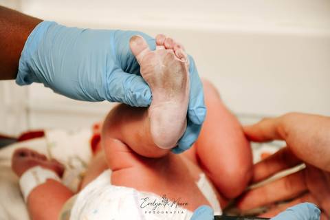 Fotografia de Parto - Newborn - Evelyn Moura Fotografia em Niterói, Rio de Janeiro - ensaio infantil - newborn de recém nascido - partos - parto em niteroi - registro de parto - maternidade são francisco'