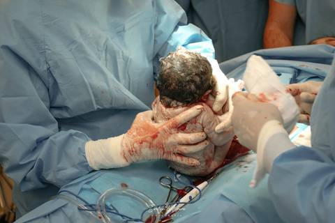 Fotografia de Parto - Newborn - Evelyn Moura Fotografia em Niterói, Rio de Janeiro - ensaio infantil - newborn de recém nascido - partos - parto em niteroi - registro de parto - maternidade são francisco - doce nascer - parto humanizado'