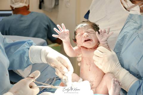 Fotografia de Parto - Newborn - Evelyn Moura Fotografia em Niterói, Rio de Janeiro - ensaio infantil - newborn de recém nascido - partos - parto em niteroi - registro de parto - maternidade são francisco - doce nascer - parto humanizado'