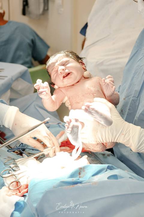 Fotografia de Parto - Newborn - Evelyn Moura Fotografia em Niterói, Rio de Janeiro - ensaio infantil - newborn de recém nascido - partos - parto em niteroi - registro de parto - maternidade são francisco - doce nascer - parto humanizado'