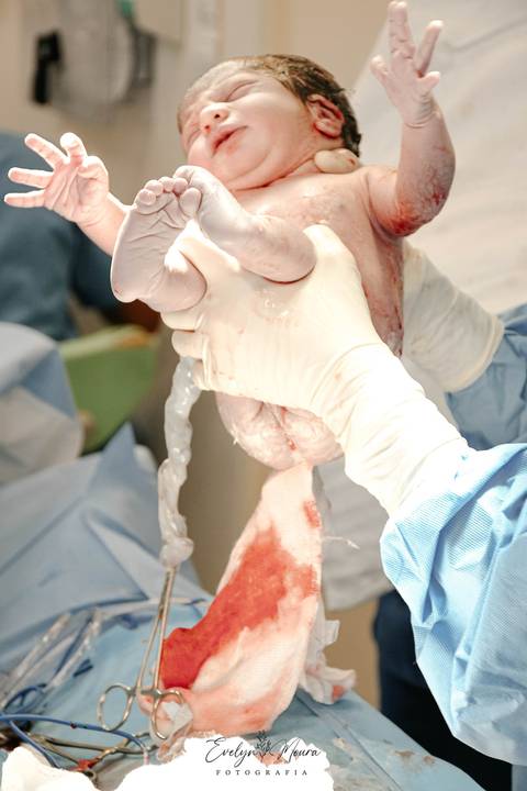 Fotografia de Parto - Newborn - Evelyn Moura Fotografia em Niterói, Rio de Janeiro - ensaio infantil - newborn de recém nascido - partos - parto em niteroi - registro de parto - maternidade são francisco - doce nascer - parto humanizado'