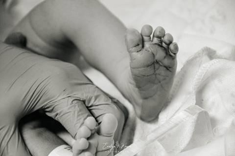 Fotografia de Parto - Newborn - Evelyn Moura Fotografia em Niterói, Rio de Janeiro - ensaio infantil - newborn de recém nascido - partos - parto em niteroi - registro de parto - maternidade são francisco - doce nascer - parto humanizado'