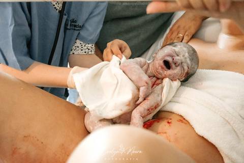 Fotografia de Parto - Newborn - Evelyn Moura Fotografia em Niterói, Rio de Janeiro - ensaio infantil - newborn de recém nascido - partos - parto em niteroi - registro de parto - maternidade são francisco - doce nascer - parto humanizado - parto normal'