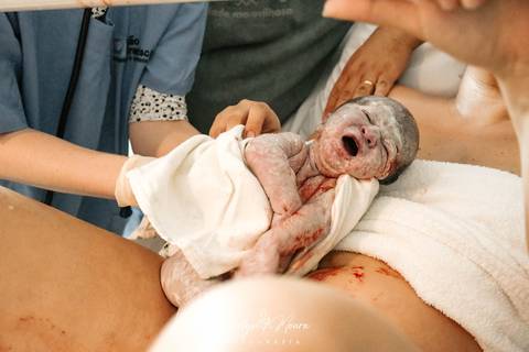 Fotografia de Parto - Newborn - Evelyn Moura Fotografia em Niterói, Rio de Janeiro - ensaio infantil - newborn de recém nascido - partos - parto em niteroi - registro de parto - maternidade são francisco - doce nascer - parto humanizado - parto normal'