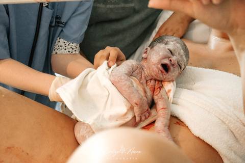 Fotografia de Parto - Newborn - Evelyn Moura Fotografia em Niterói, Rio de Janeiro - ensaio infantil - newborn de recém nascido - partos - parto em niteroi - registro de parto - maternidade são francisco - doce nascer - parto humanizado - parto normal'