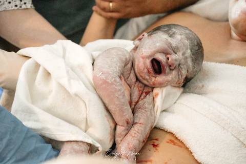 Fotografia de Parto - Newborn - Evelyn Moura Fotografia em Niterói, Rio de Janeiro - ensaio infantil - newborn de recém nascido - partos - parto em niteroi - registro de parto - maternidade são francisco - doce nascer - parto humanizado - parto normal'