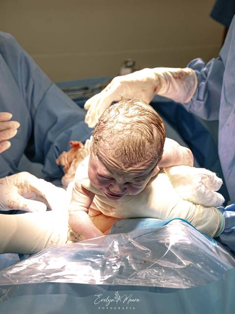 Fotografia de Parto - Newborn - Evelyn Moura Fotografia em Niterói, Rio de Janeiro - ensaio infantil - newborn de recém nascido - partos - parto em niteroi - registro de parto - maternidade são francisco - doce nascer - parto humanizado - parto normal '