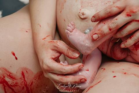 Fotografia de Parto - Newborn - Evelyn Moura Fotografia em Niterói, Rio de Janeiro - ensaio infantil - newborn de recém nascido - partos - parto em niteroi - registro de parto - maternidade chn - parto normal - doce nascer - parto humanizado'