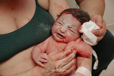 Fotografia de Parto - Newborn - Evelyn Moura Fotografia em Niterói, Rio de Janeiro - ensaio infantil - newborn de recém nascido - partos - parto em niteroi - registro de parto - maternidade chn - parto normal - doce nascer - parto humanizado'