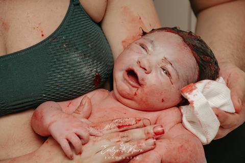 Fotografia de Parto - Newborn - Evelyn Moura Fotografia em Niterói, Rio de Janeiro - ensaio infantil - newborn de recém nascido - partos - parto em niteroi - registro de parto - maternidade chn - parto normal - doce nascer - parto humanizado'