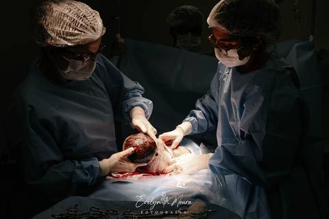 Fotografia de Parto - Newborn - Evelyn Moura Fotografia em Niterói, Rio de Janeiro - ensaio infantil - newborn de recém nascido - partos - parto em niteroi - registro de parto - maternidade são francisco - doce nascer - parto humanizado'