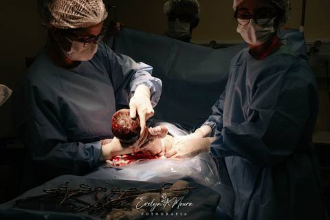 Fotografia de Parto - Newborn - Evelyn Moura Fotografia em Niterói, Rio de Janeiro - ensaio infantil - newborn de recém nascido - partos - parto em niteroi - registro de parto - maternidade são francisco - doce nascer - parto humanizado'