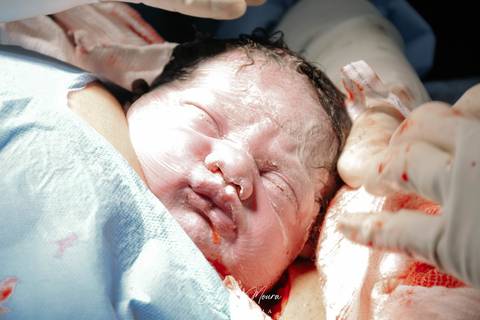 Fotografia de Parto - Newborn - Evelyn Moura Fotografia em Niterói, Rio de Janeiro - ensaio infantil - newborn de recém nascido - partos - parto em niteroi - registro de parto - maternidade são francisco - doce nascer - parto humanizado - andrea barbosa'