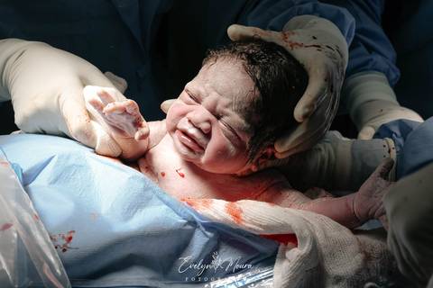 Fotografia de Parto - Newborn - Evelyn Moura Fotografia em Niterói, Rio de Janeiro - ensaio infantil - newborn de recém nascido - partos - parto em niteroi - registro de parto - maternidade são francisco - doce nascer - parto humanizado - andrea barbosa'