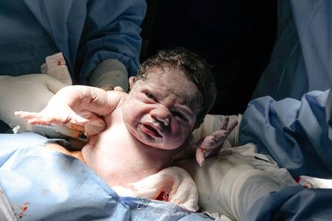 Fotografia de Parto - Newborn - Evelyn Moura Fotografia em Niterói, Rio de Janeiro - ensaio infantil - newborn de recém nascido - partos - parto em niteroi - registro de parto - maternidade são francisco - doce nascer - parto humanizado - andrea barbosa'