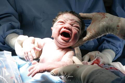 Fotografia de Parto - Newborn - Evelyn Moura Fotografia em Niterói, Rio de Janeiro - ensaio infantil - newborn de recém nascido - partos - parto em niteroi - registro de parto - maternidade são francisco - doce nascer - parto humanizado - andrea barbosa'