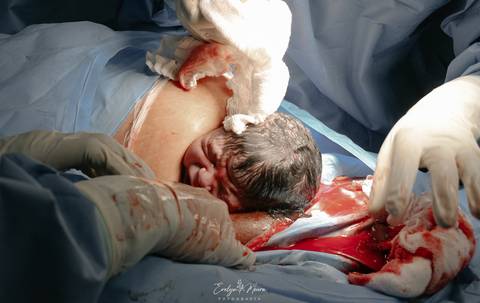 Fotografia de Parto - Newborn - Evelyn Moura Fotografia em Niterói, Rio de Janeiro - ensaio infantil - newborn de recém nascido - partos - parto em niteroi - registro de parto - maternidade são francisco - doce nascer - parto humanizado - andrea barbosa '