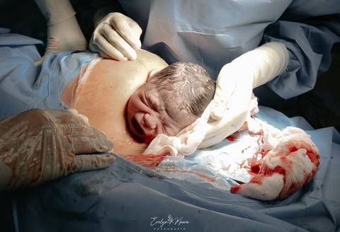 Fotografia de Parto - Newborn - Evelyn Moura Fotografia em Niterói, Rio de Janeiro - ensaio infantil - newborn de recém nascido - partos - parto em niteroi - registro de parto - maternidade são francisco - doce nascer - parto humanizado - andrea barbosa '