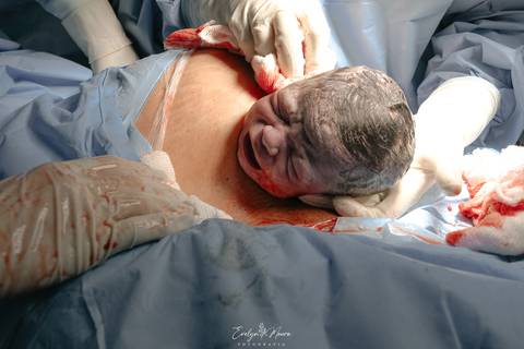 Fotografia de Parto - Newborn - Evelyn Moura Fotografia em Niterói, Rio de Janeiro - ensaio infantil - newborn de recém nascido - partos - parto em niteroi - registro de parto - maternidade são francisco - doce nascer - parto humanizado - andrea barbosa '