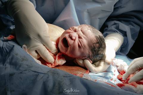 Fotografia de Parto - Newborn - Evelyn Moura Fotografia em Niterói, Rio de Janeiro - ensaio infantil - newborn de recém nascido - partos - parto em niteroi - registro de parto - maternidade são francisco - doce nascer - parto humanizado - andrea barbosa '