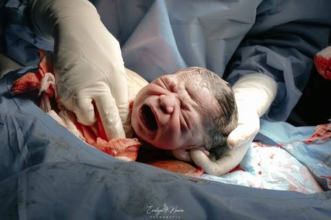 Fotografia de Parto - Newborn - Evelyn Moura Fotografia em Niterói, Rio de Janeiro - ensaio infantil - newborn de recém nascido - partos - parto em niteroi - registro de parto - maternidade são francisco - doce nascer - parto humanizado - andrea barbosa '