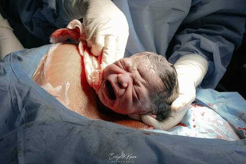 Fotografia de Parto - Newborn - Evelyn Moura Fotografia em Niterói, Rio de Janeiro - ensaio infantil - newborn de recém nascido - partos - parto em niteroi - registro de parto - maternidade são francisco - doce nascer - parto humanizado - andrea barbosa '