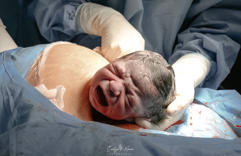 Fotografia de Parto - Newborn - Evelyn Moura Fotografia em Niterói, Rio de Janeiro - ensaio infantil - newborn de recém nascido - partos - parto em niteroi - registro de parto - maternidade são francisco - doce nascer - parto humanizado - andrea barbosa '