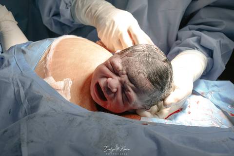 Fotografia de Parto - Newborn - Evelyn Moura Fotografia em Niterói, Rio de Janeiro - ensaio infantil - newborn de recém nascido - partos - parto em niteroi - registro de parto - maternidade são francisco - doce nascer - parto humanizado - andrea barbosa '