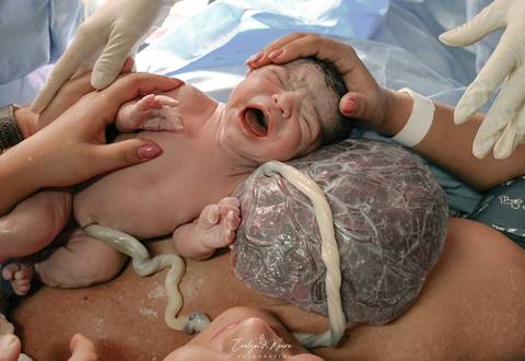 Fotografia de Parto - Newborn - Evelyn Moura Fotografia em Niterói, Rio de Janeiro - ensaio infantil - newborn de recém nascido - partos - parto em niteroi - registro de parto - maternidade são francisco - doce nascer - parto humanizado - andrea barbosa '