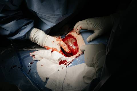 Fotografia de Parto - Newborn - Evelyn Moura Fotografia em Niterói, Rio de Janeiro - ensaio infantil - newborn de recém nascido - partos - parto em niteroi - registro de parto - maternidade são francisco - doce nascer - parto humanizado - andrea barbosa '