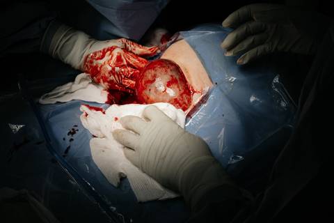 Fotografia de Parto - Newborn - Evelyn Moura Fotografia em Niterói, Rio de Janeiro - ensaio infantil - newborn de recém nascido - partos - parto em niteroi - registro de parto - maternidade são francisco - doce nascer - parto humanizado - andrea barbosa '