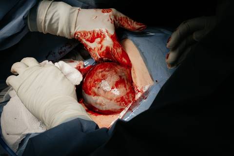 Fotografia de Parto - Newborn - Evelyn Moura Fotografia em Niterói, Rio de Janeiro - ensaio infantil - newborn de recém nascido - partos - parto em niteroi - registro de parto - maternidade são francisco - doce nascer - parto humanizado - andrea barbosa '