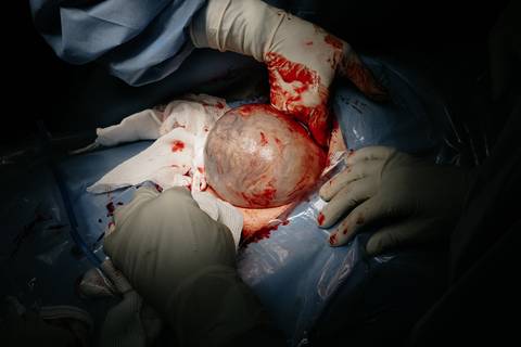 Fotografia de Parto - Newborn - Evelyn Moura Fotografia em Niterói, Rio de Janeiro - ensaio infantil - newborn de recém nascido - partos - parto em niteroi - registro de parto - maternidade são francisco - doce nascer - parto humanizado - andrea barbosa '