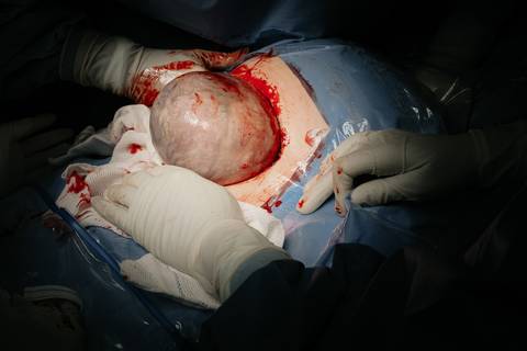 Fotografia de Parto - Newborn - Evelyn Moura Fotografia em Niterói, Rio de Janeiro - ensaio infantil - newborn de recém nascido - partos - parto em niteroi - registro de parto - maternidade são francisco - doce nascer - parto humanizado - andrea barbosa '