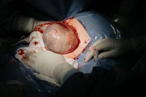 Fotografia de Parto - Newborn - Evelyn Moura Fotografia em Niterói, Rio de Janeiro - ensaio infantil - newborn de recém nascido - partos - parto em niteroi - registro de parto - maternidade são francisco - doce nascer - parto humanizado - andrea barbosa '