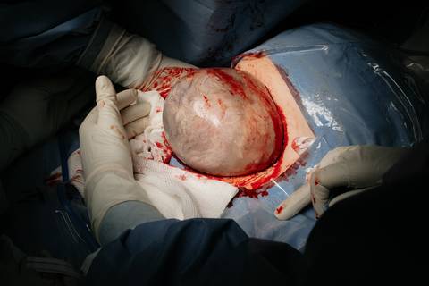 Fotografia de Parto - Newborn - Evelyn Moura Fotografia em Niterói, Rio de Janeiro - ensaio infantil - newborn de recém nascido - partos - parto em niteroi - registro de parto - maternidade são francisco - doce nascer - parto humanizado - andrea barbosa '