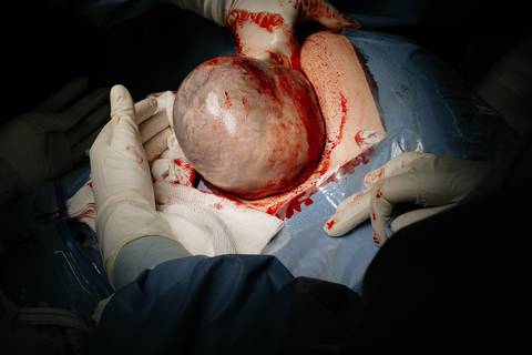 Fotografia de Parto - Newborn - Evelyn Moura Fotografia em Niterói, Rio de Janeiro - ensaio infantil - newborn de recém nascido - partos - parto em niteroi - registro de parto - maternidade são francisco - doce nascer - parto humanizado - andrea barbosa '